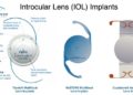 Which lens is best for cataract surgery?